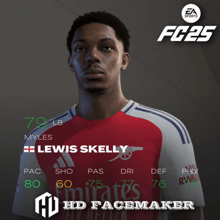 MYLES LEWIS-SKELLY 2025